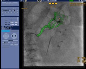 product-product-categories-Intervantional - 2016-vessel_12.jpg