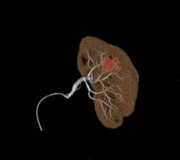 product-product-categories-Intervantional - 2016-vessel_11.jpg