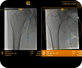 product-product-categories-Intervantional - 2016-vessel_12.jpg