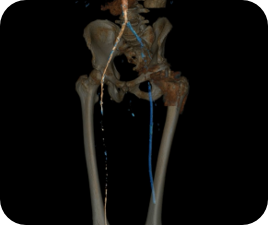 product-product-categories-Intervantional - 2016-vessel_11.jpg