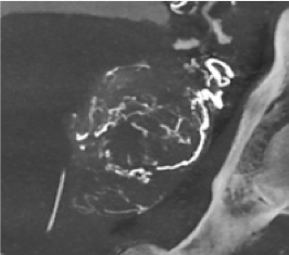 product-product-categories-Intervantional - 2016-vessel_13.jpg