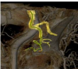 product-product-categories-Intervantional - 2016-vessel_11.jpg