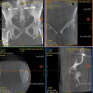 product-product-categories-Intervantional - 2016-needle_21.jpg