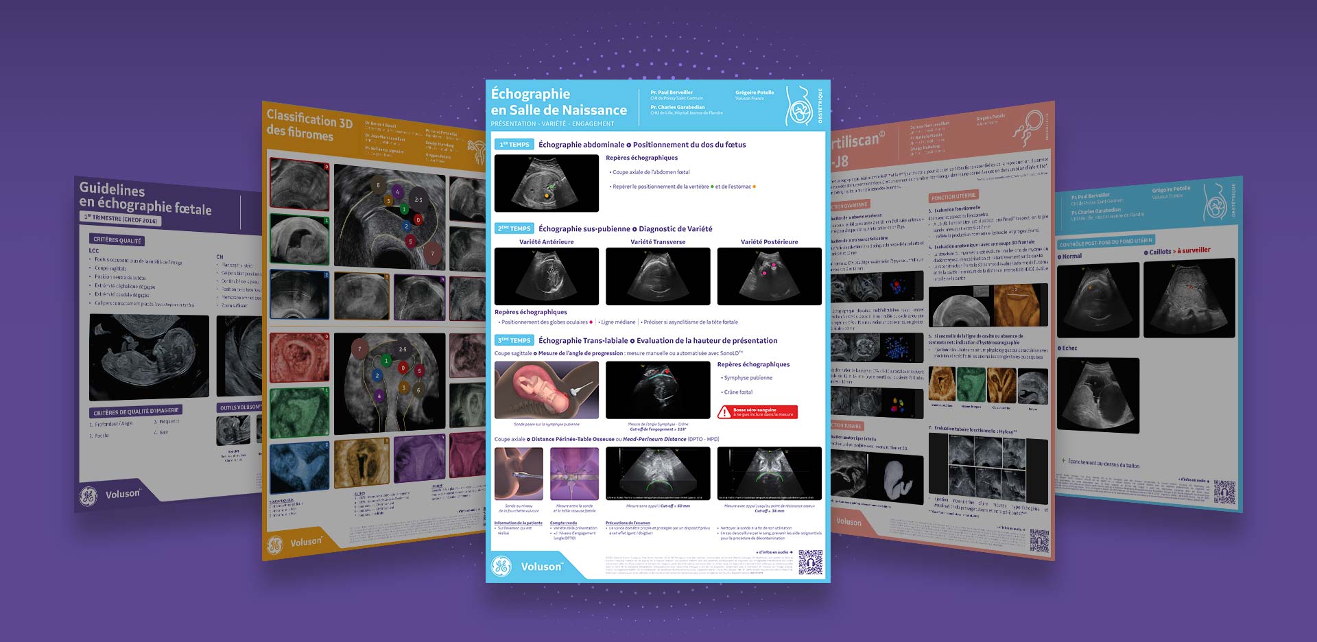 Obstetrique-echographie-salle-naissance