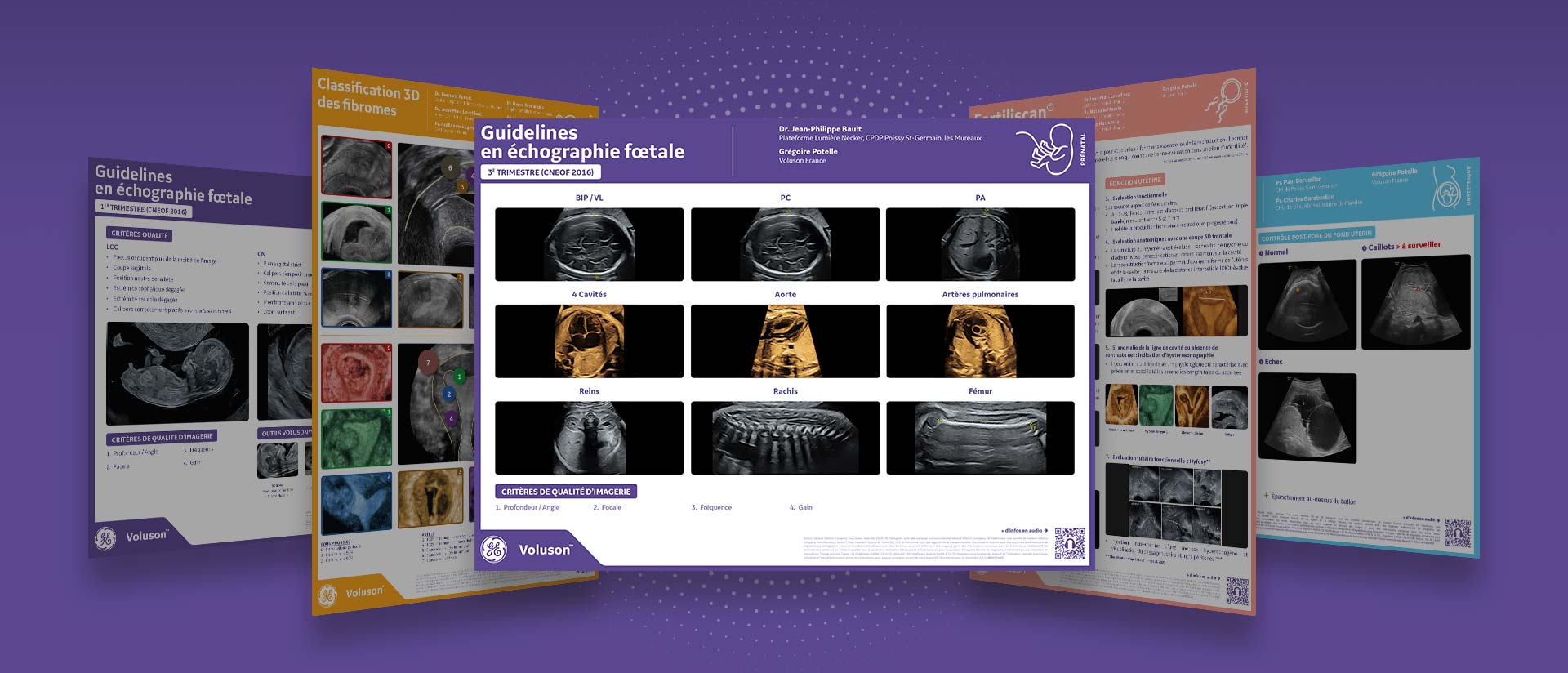 Mcokup-echographie-foetale-3emetrimestre