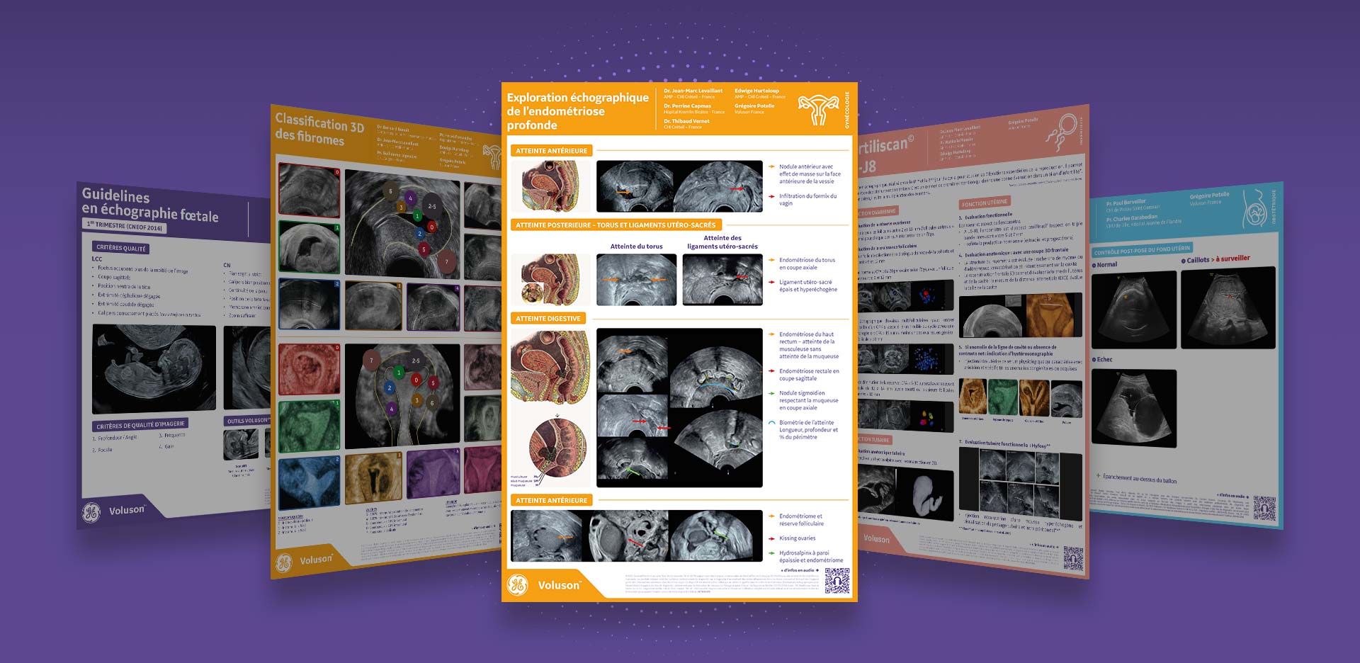 image-full-endometriose