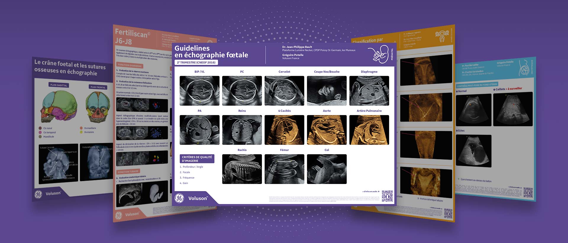 image-full2-second-trimestre