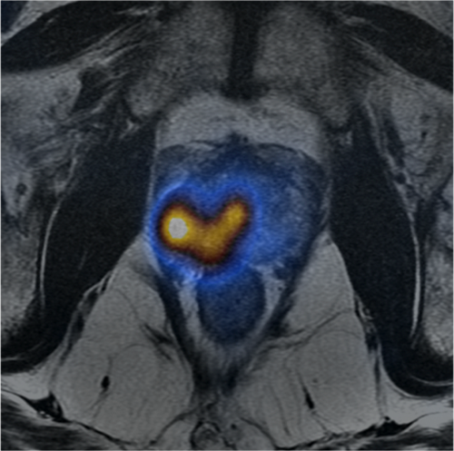 product-product-categories-magnetic-resonance-imaging-signa petmr-InVivo 3 -small.png