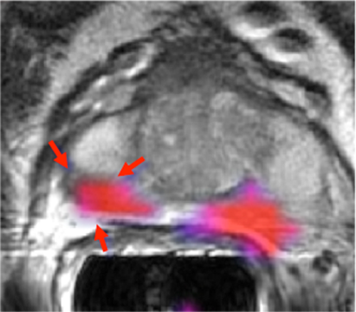 product-product-categories-magnetic-resonance-imaging-signa petmr-InVivo 1.png