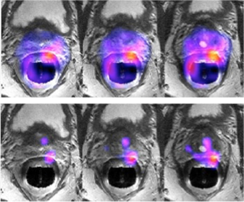 product-product-categories-magnetic-resonance-imaging-signa petmr-InVivo 2.png