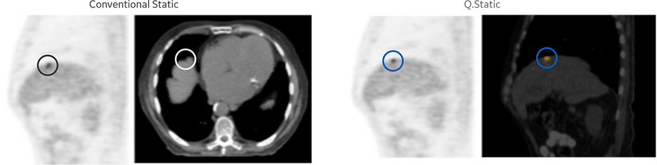 product-product-categories-magnetic-resonance-imaging-signa petmr-Motion Correction.png