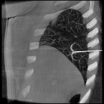 product-product-categories-Intervantional - 2016-needle_33.jpg