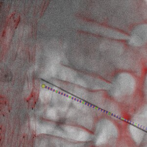 product-product-categories-Intervantional - 2016-needle_42.jpg