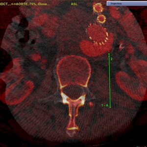 product-product-categories-Intervantional - 2016-needle_43.jpg