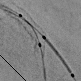 product-product-categories-Intervantional - 2016-pci_12.jpg