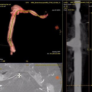 product-product-categories-Intervantional - 2016-vessel_21.jpg