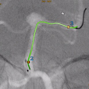 product-product-categories-Intervantional - 2016-vessel_22.jpg