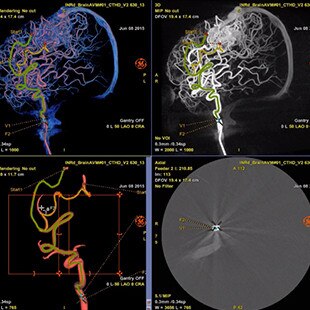 product-product-categories-Intervantional - 2016-vessel_31.jpg