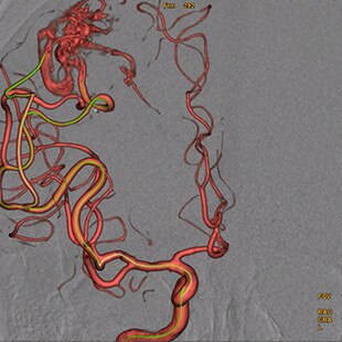 product-product-categories-Intervantional - 2016-vessel_32.jpg