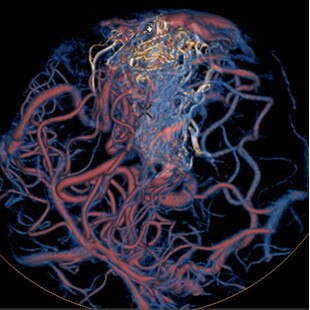 product-product-categories-Intervantional - 2016-vessel_33.jpg