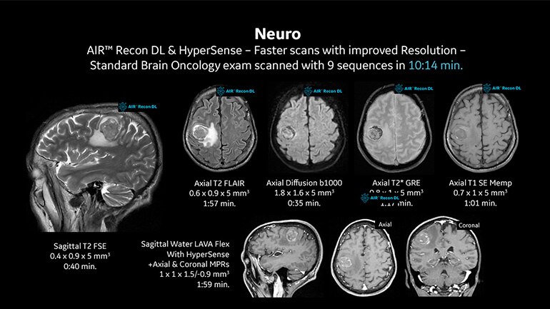 【専用】外来診療の Uncommon Disease Vol. 1 .2.3 MycoRev_Neuro_Small3.webp?v=