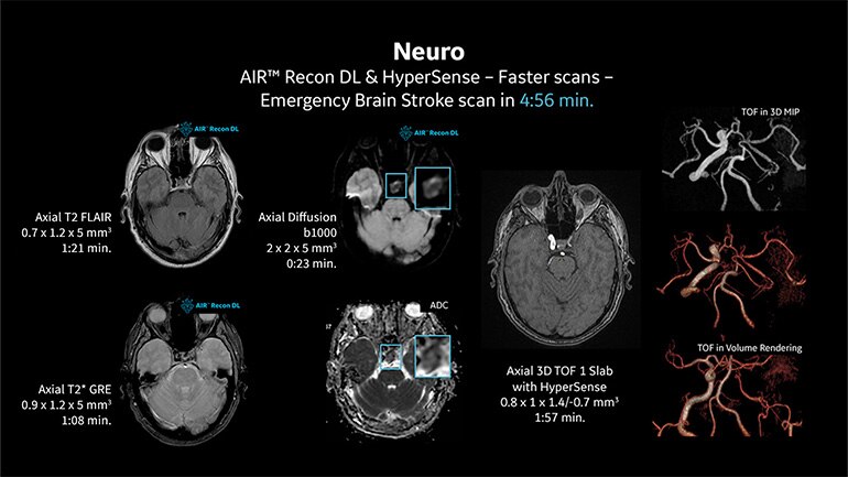 Clinical Images Gallery | GE HealthCare (Middle East)