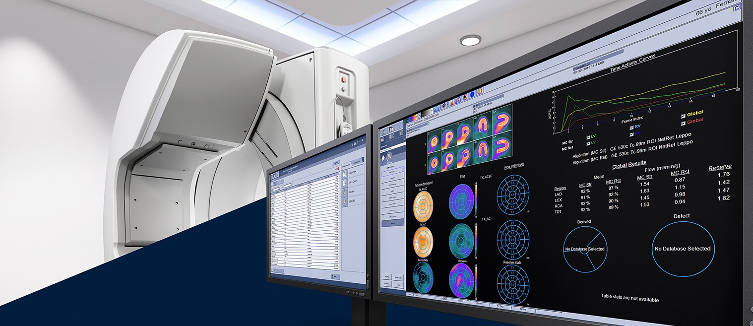 GEHCMyoSPECTPWPTechnologyImage1