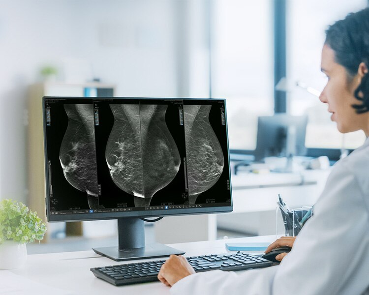Seno Iris™ | GE HealthCare (Middle East)