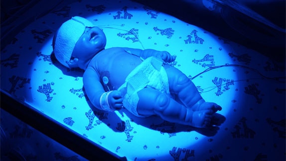 Giraffe Blue Spot Pt Lite Phototherapy System for Maternal