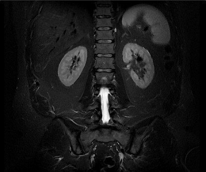 ategories-magnetic-resonance-imaging-signa artist-signa-rtist-webpage-define-image-new.jpg